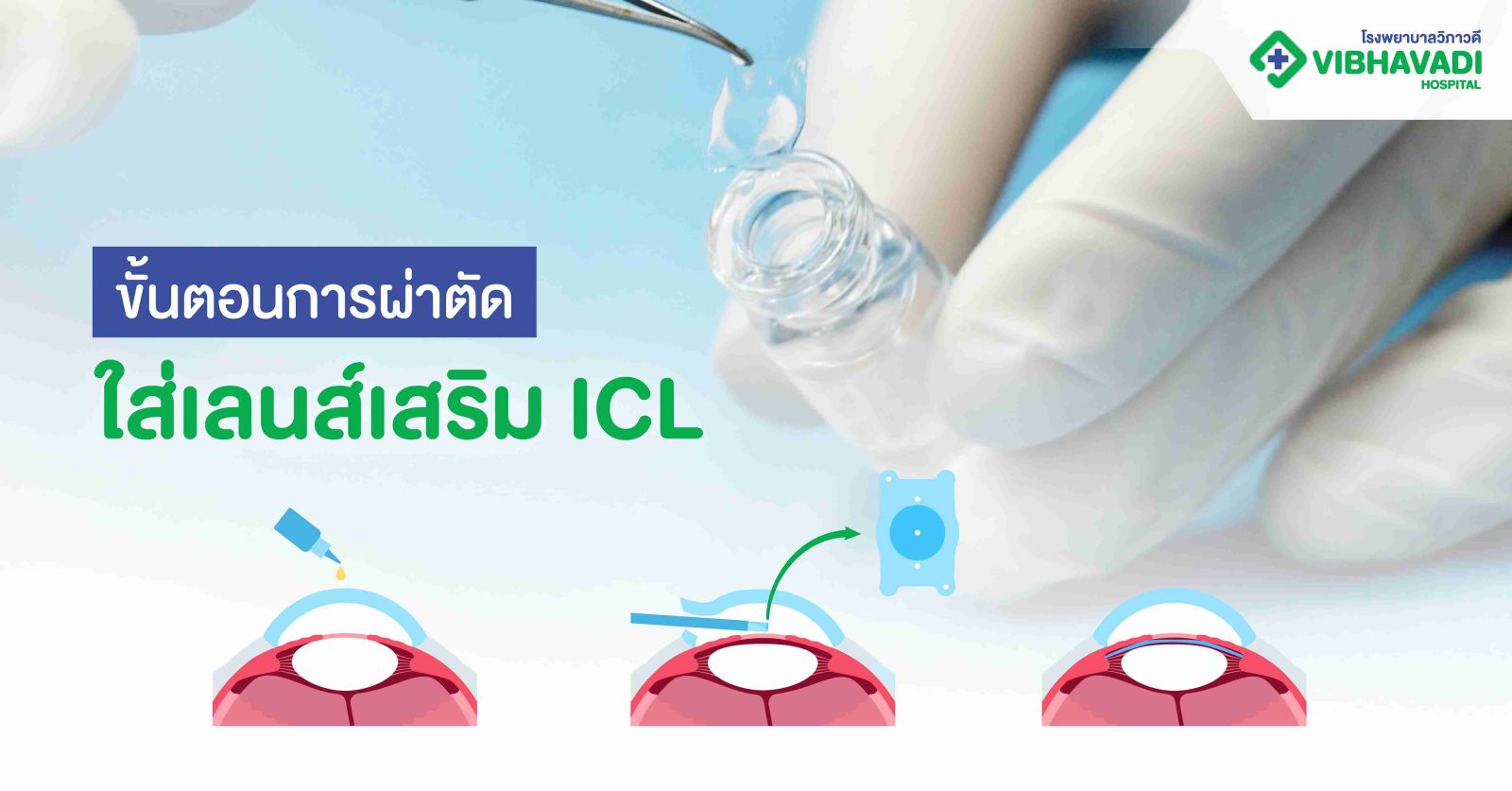 ขั้นตอนการผ่าตัดใส่เลนส์เสริม ICL 