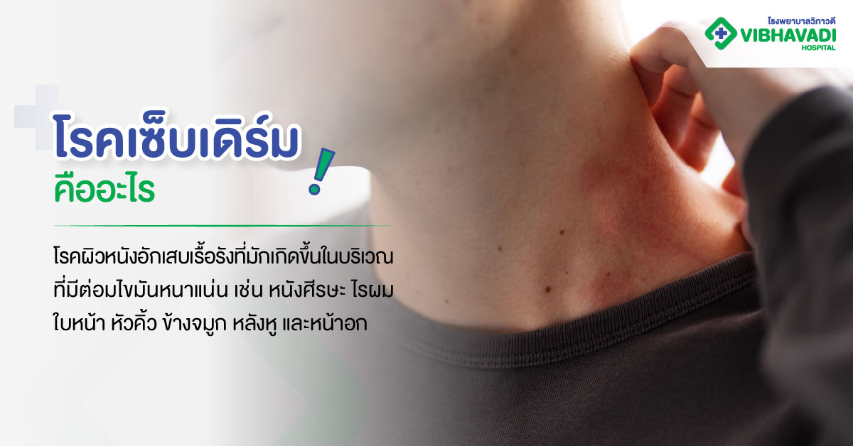 โรคเซ็บเดิร์ม คืออะไร