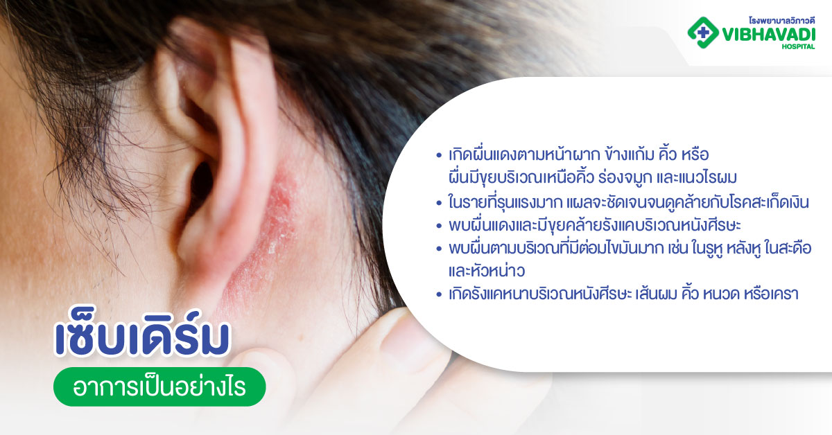 เซ็บเดิร์มอาการเป็นอย่างไร