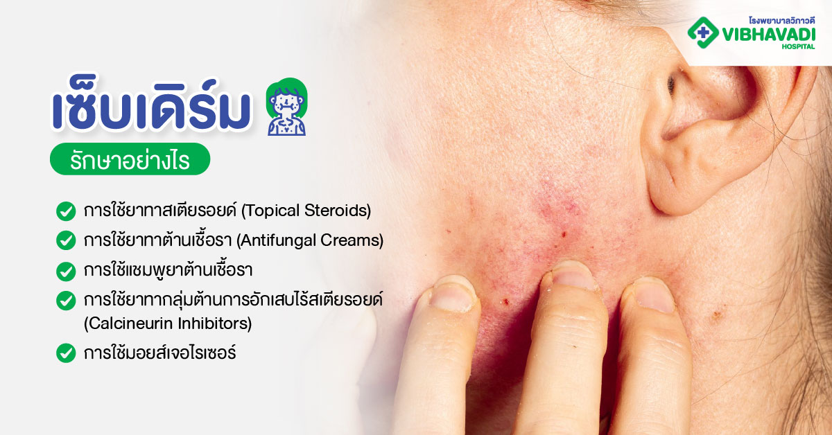 เซ็บเดิร์มรักษาอย่างไร