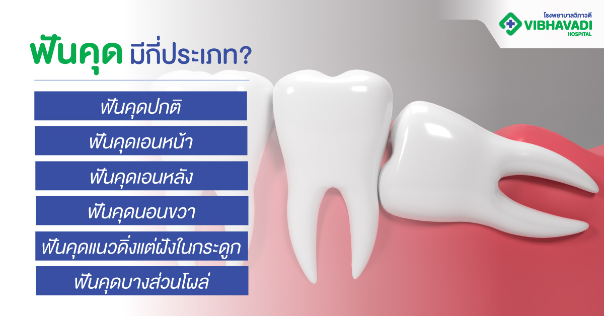 ฟันคุดมีกี่ประเภท?