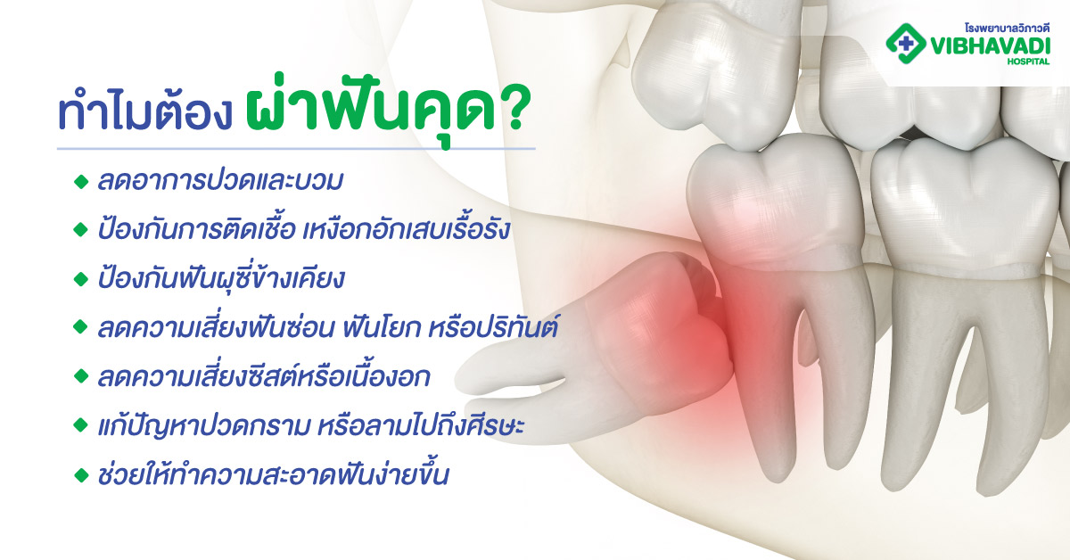 ทำไมต้องผ่าฟันคุด?