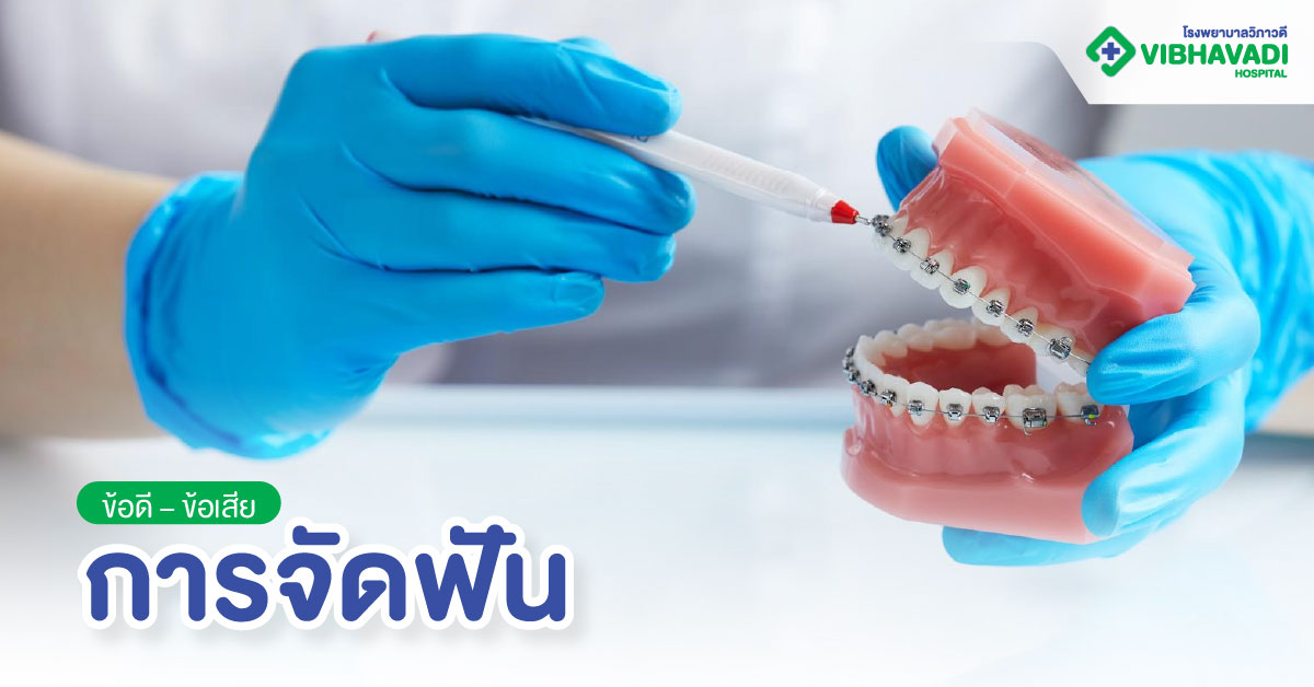 ข้อดีข้อเสียของการจัดฟัน