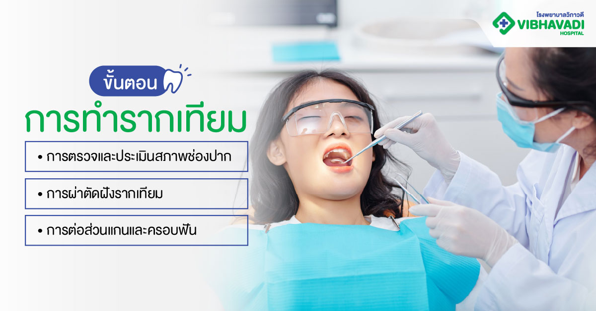ขั้นตอนการทำรากเทียม