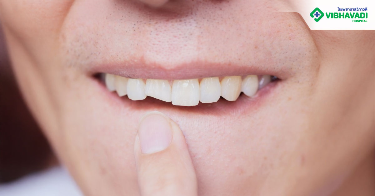 ฟันหักหรือเสียหายมาก