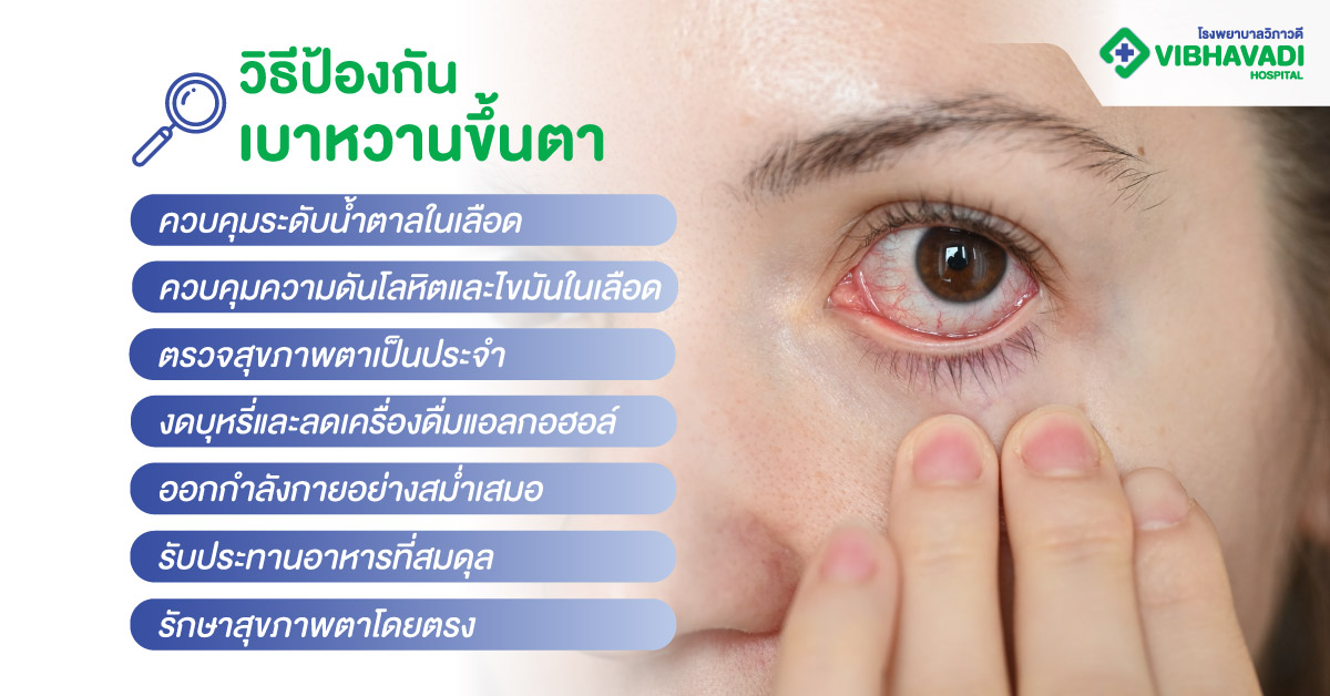 วิธีป้องกันเบาหวานขึ้นตา