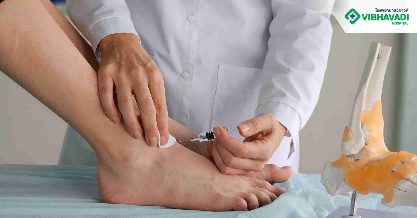 วิธีรักษา Ganglion Cyst