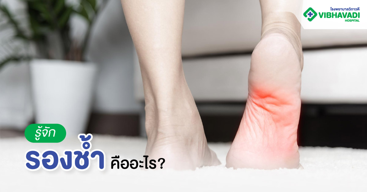 รู้จักรองช้ำ คืออะไร?