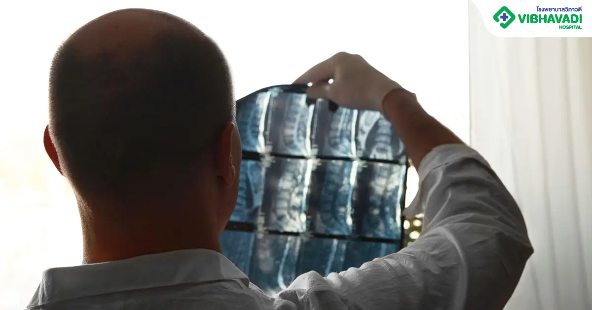 กระดูกสันหลังยุบ รักษา