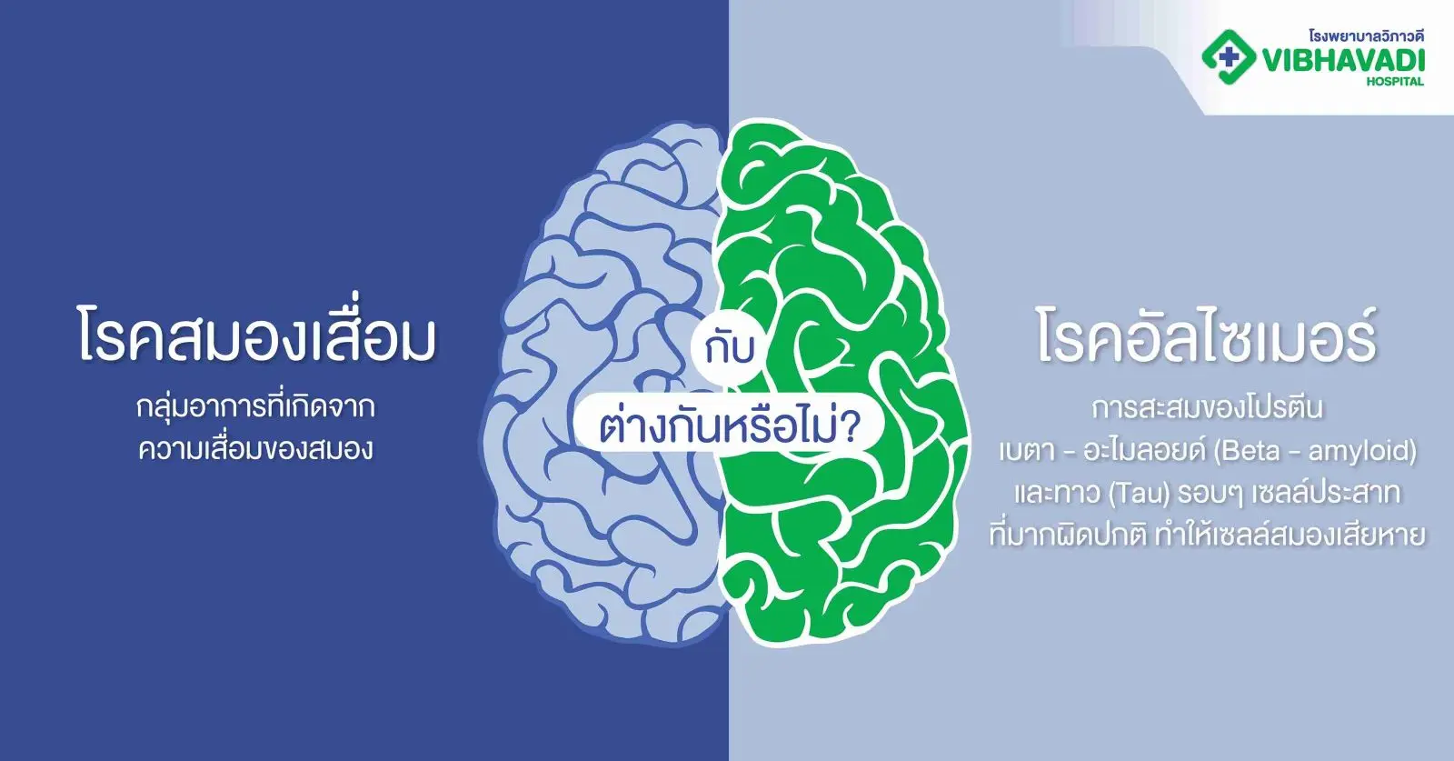 โรคอัลไซเมอร์ วิธีรักษา