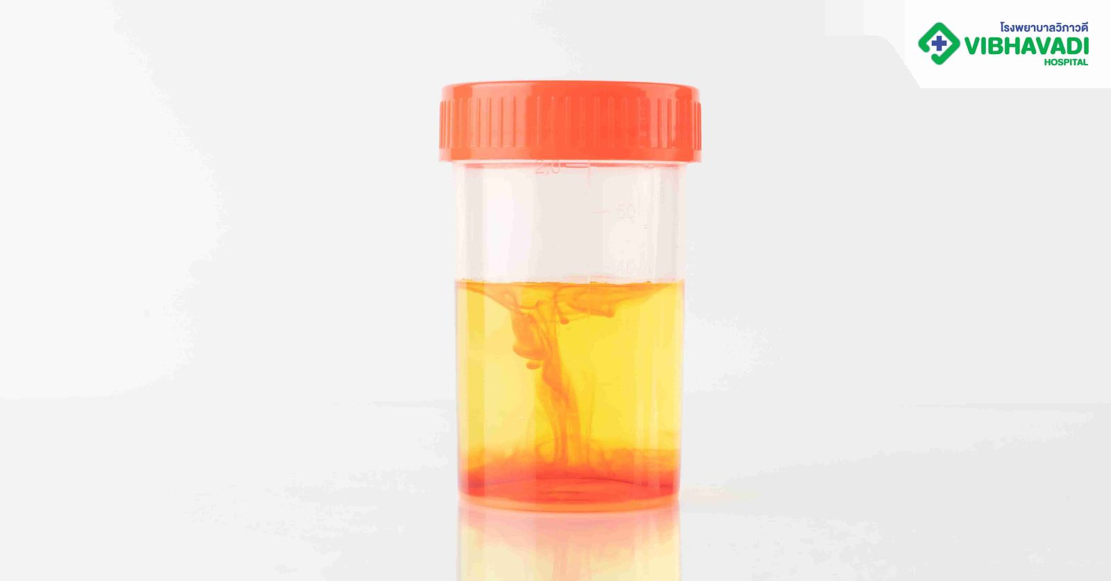 Bladder Cancer Symptoms