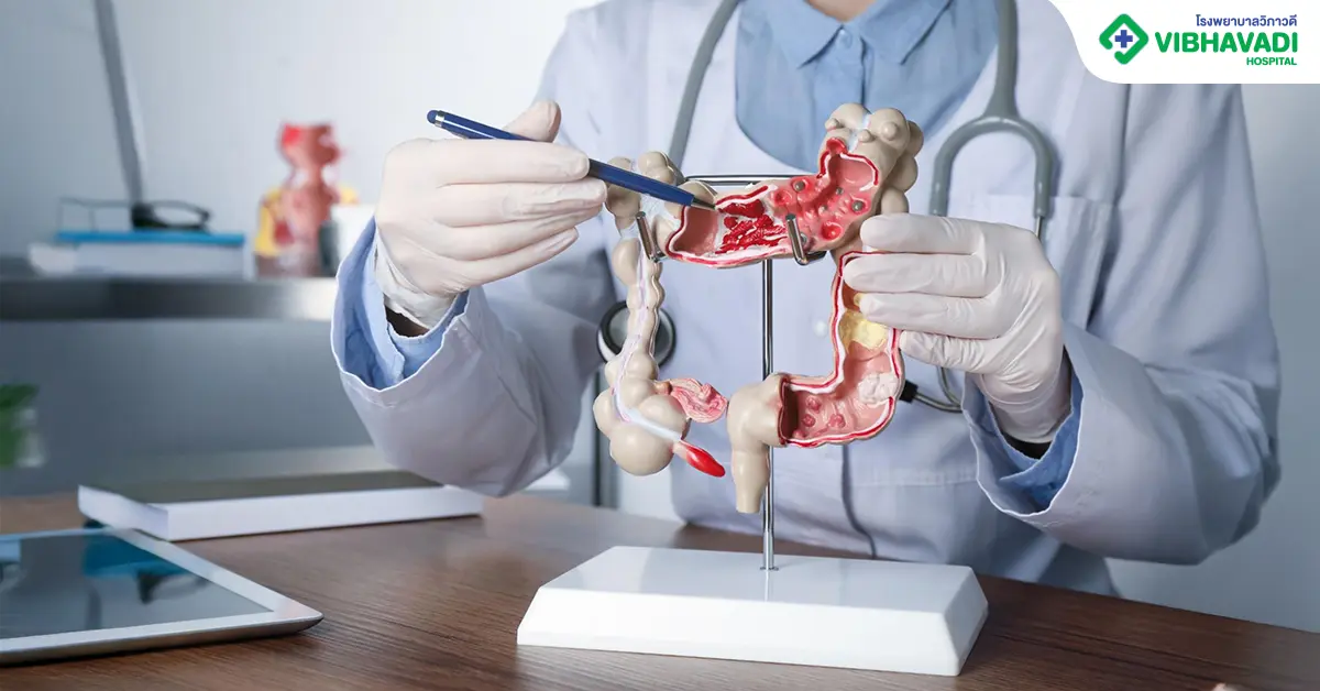 มะเร็งลำไส้ อาการ ระยะแรก