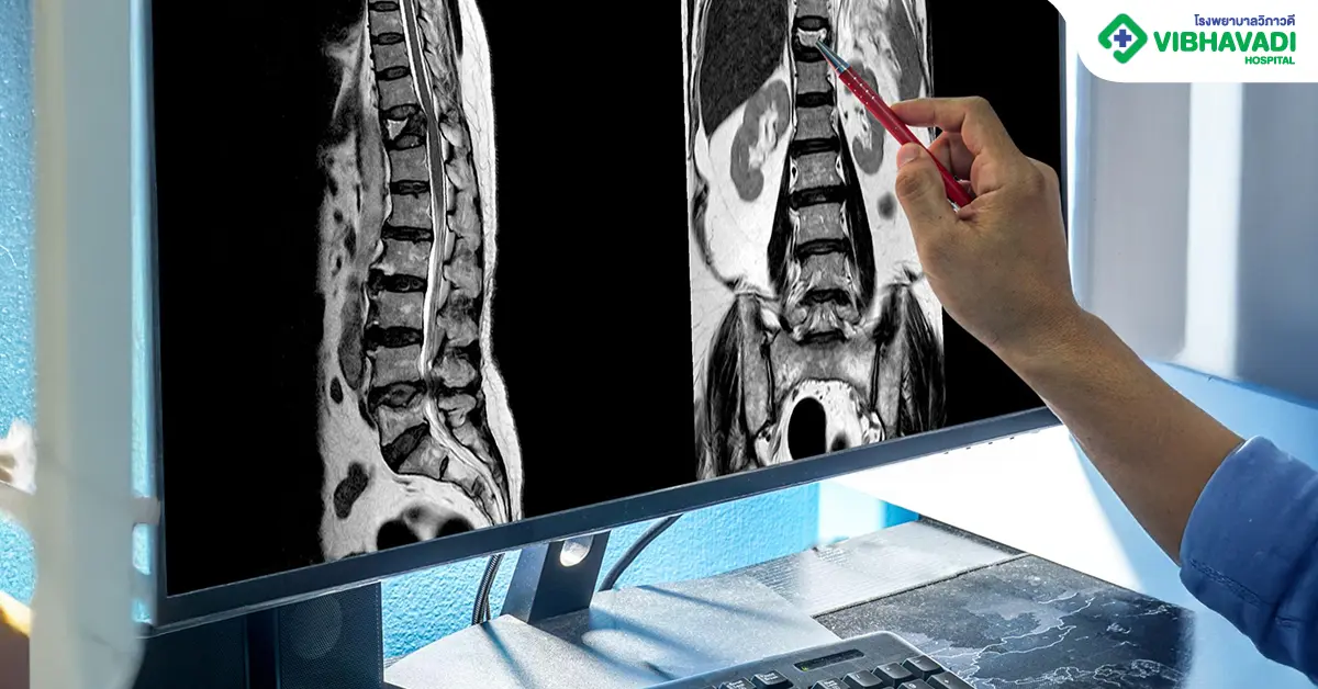 วิธีผ่าตัดกระดูกสันหลัง