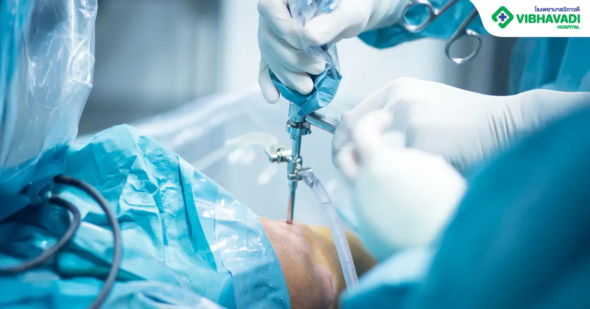 การผ่าตัดส่องกล้อง