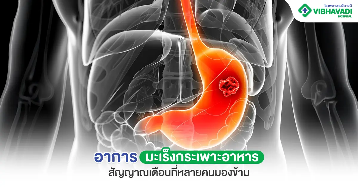อาการมะเร็งกระเพาะอาหาร